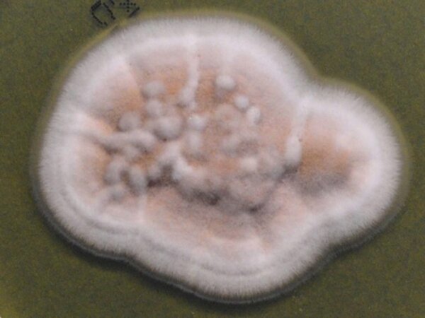 Επιθέματα από ζωντανούς μύκητες: Είναι αυτό το μέλλον της επούλωσης τραυμάτων;